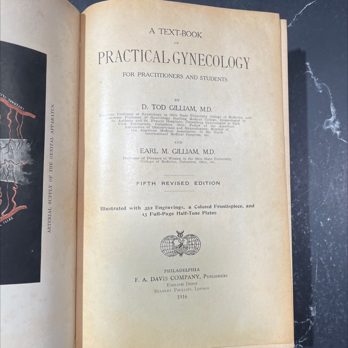 arterial supply of the genital apparatus. a text-book of practical gynecology for practitioners and students book, by image 2