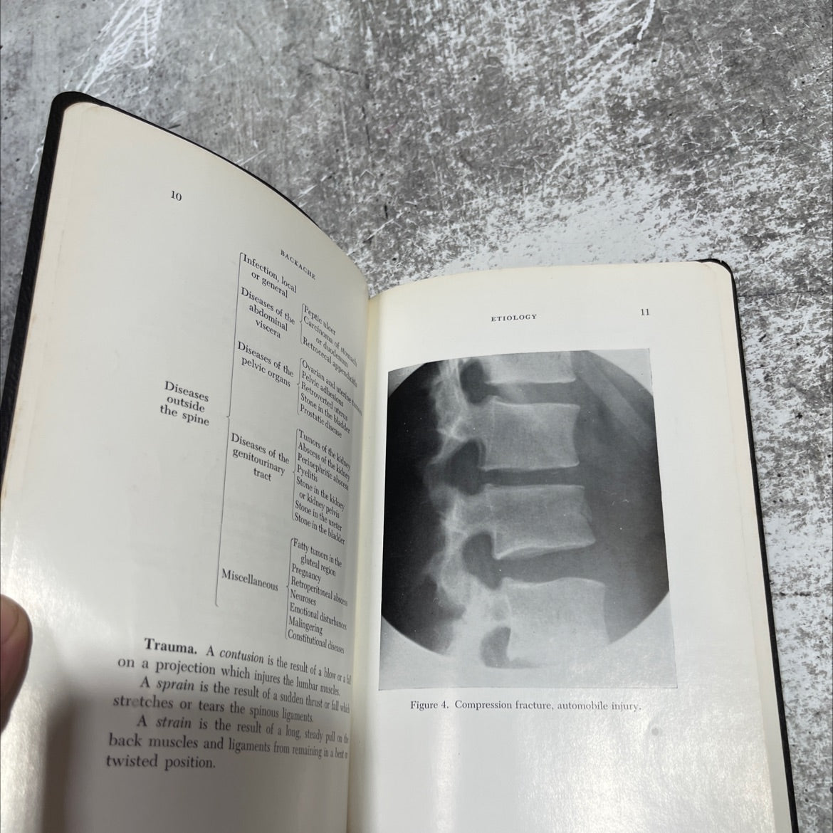 backache book, by frank r. ober, m.d., 1955 Leather image 4