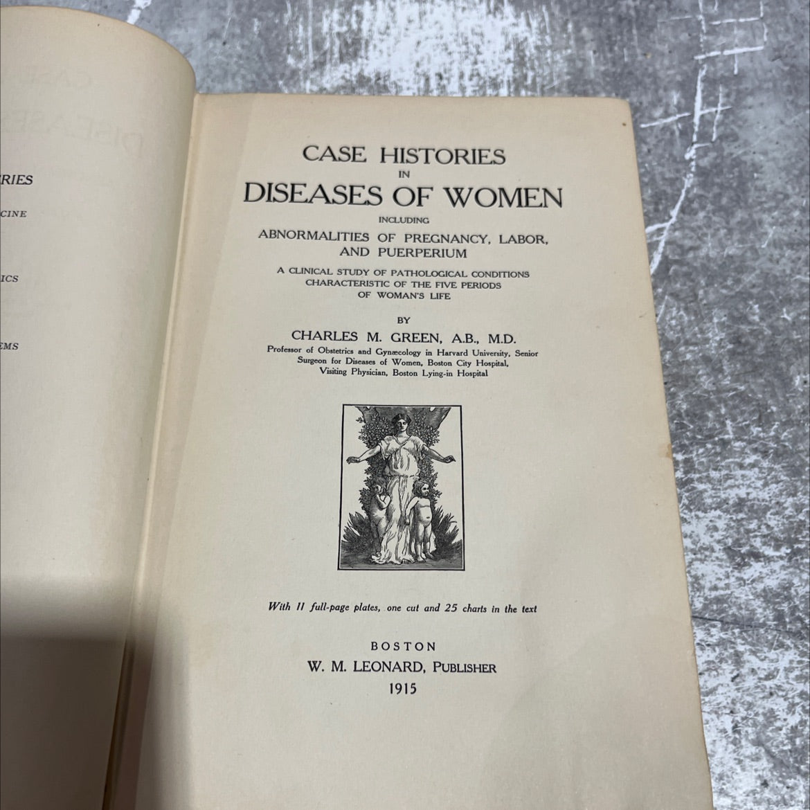 cries cine ics case histories in diseases of women including abnormalities of pregnancy, labor, and puerperium a image 2