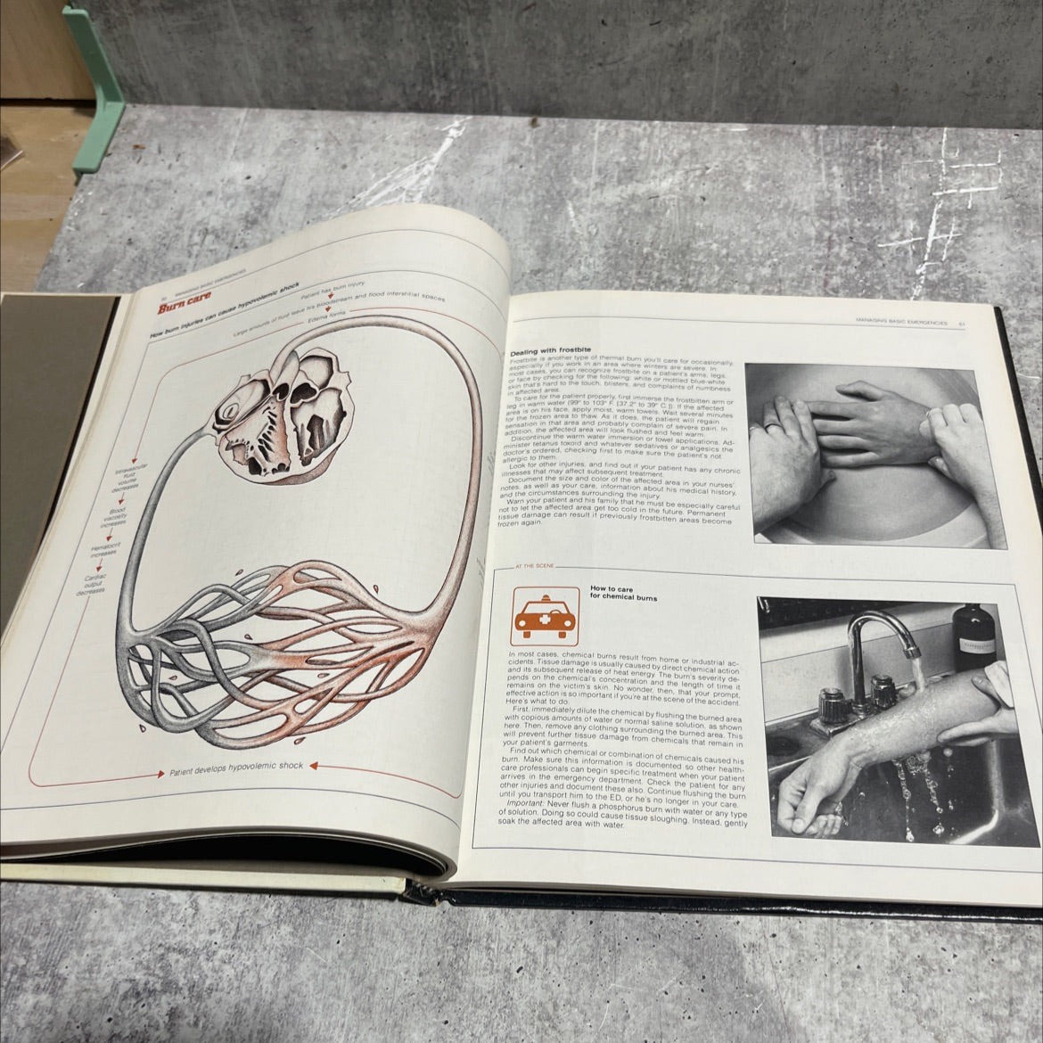 dealing with emergencies book, by unknown, 1981 Hardcover image 4
