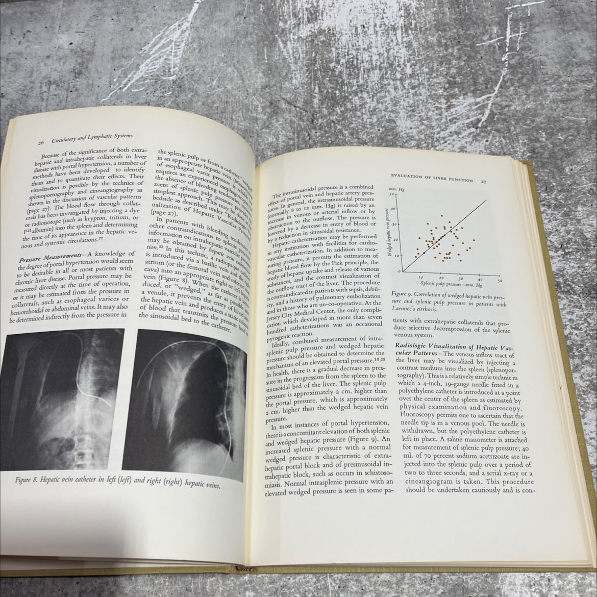 evaluation of liver function in clinical practice book, by Carroll M. Leevy, M.D., F.A.C.P., 1965 Hardcover image 4