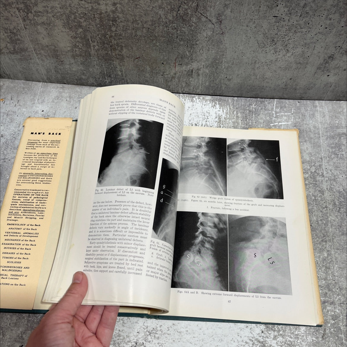 man's back book, by theodore a. willis, m.d., fa.c.s, 1958 Hardcover image 4