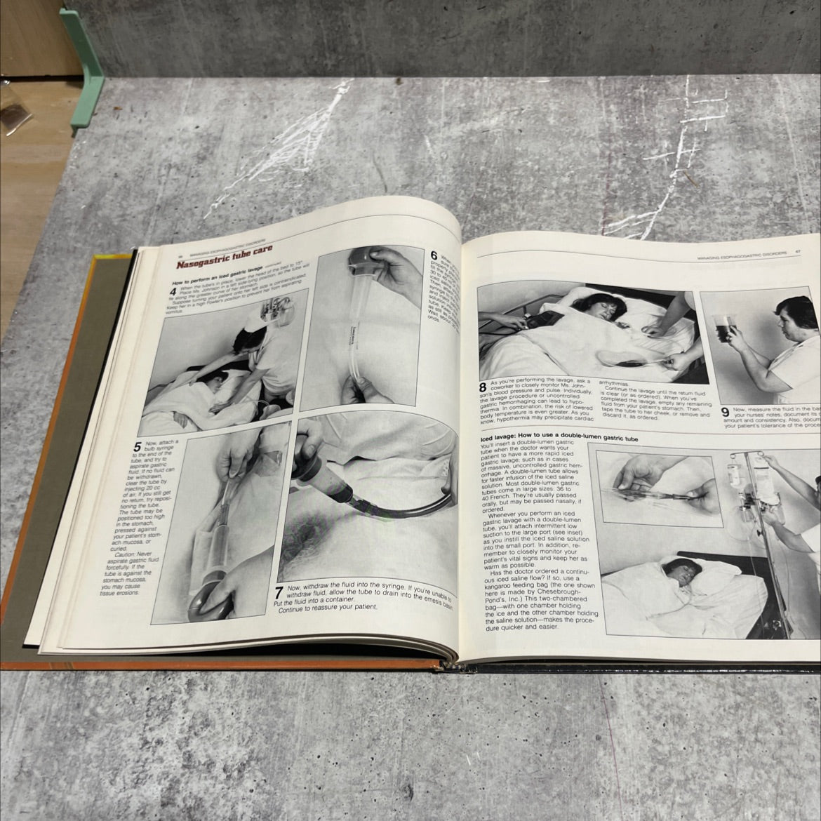 nursing photobookm performing gi procedures book, by Marjorie L. Beck, Mike D'Orazio, Mary Jane Koch, Barbara K. image 4
