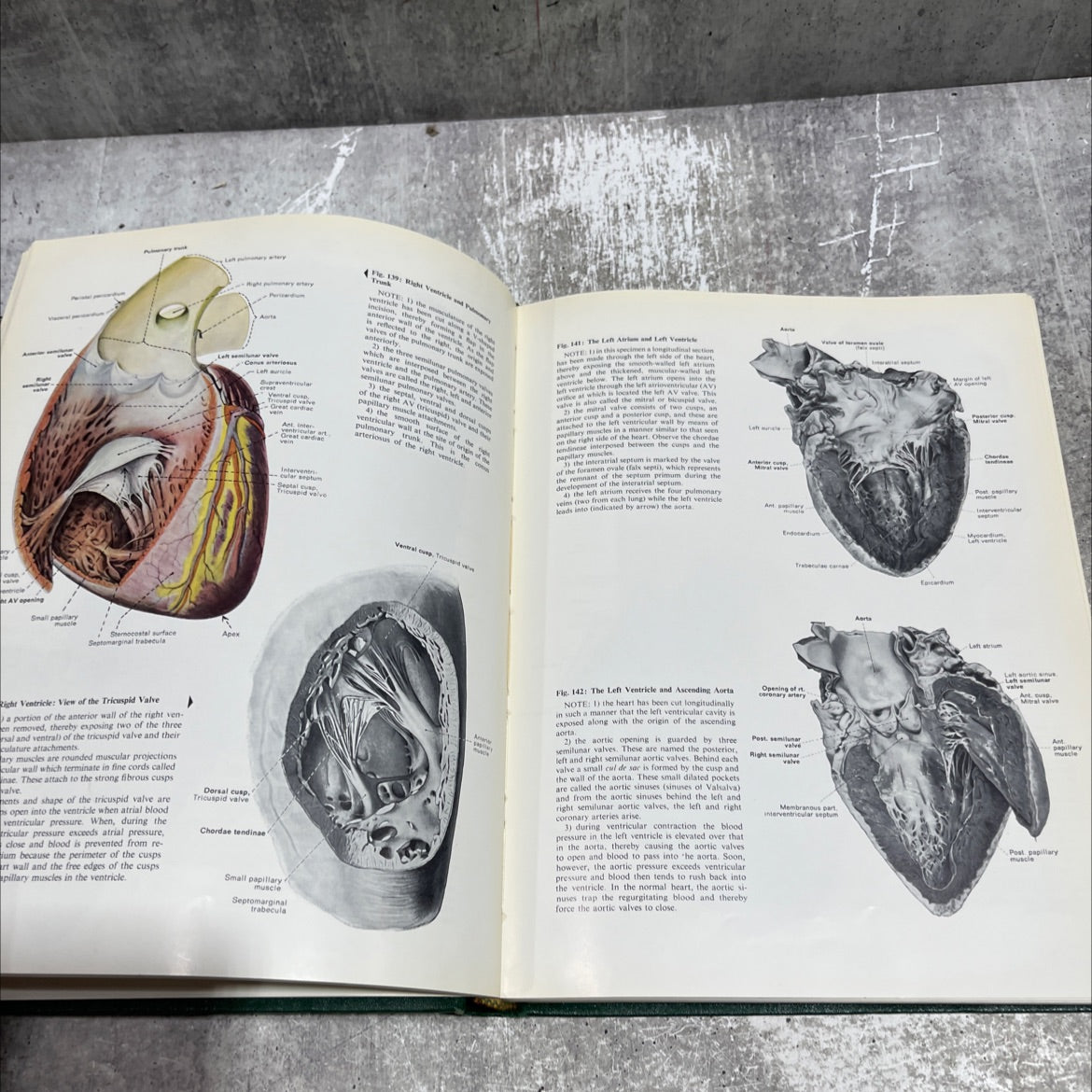perl mugsleyf anatomy a regional atlas of the human body book, by carmine d. clemente, 1975 Hardcover image 4