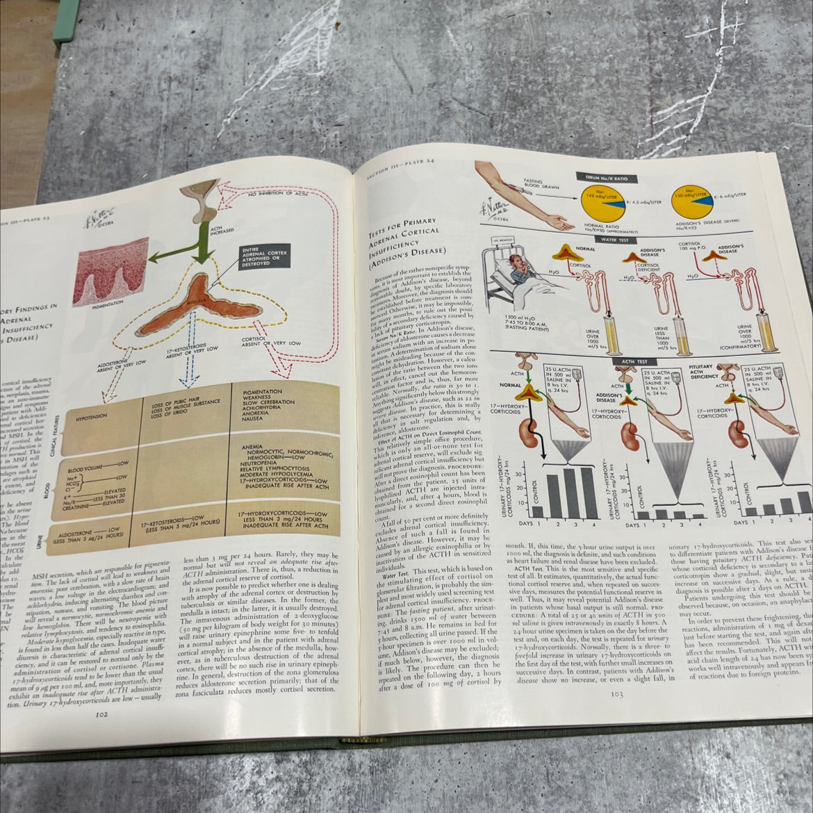 the ciba collection of medical illustrations volume 4 a compilation of paintings on the anatomy and pathophysiology of image 4