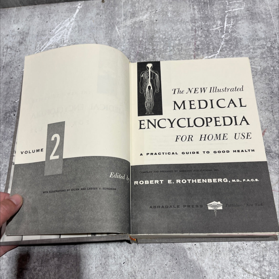 the new illustrated medical encyclopedia for home use book, by robert e. rothenberg, m.d., f.a.c.s., 1978 Hardcover image 2