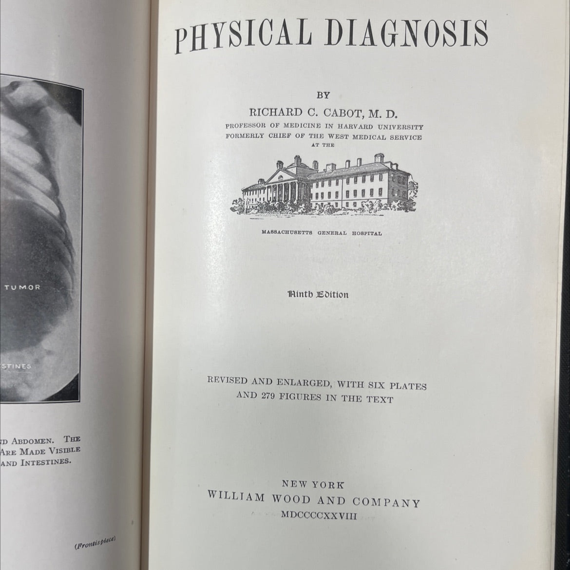 tumor stines d abdomen the are made visible and intestines physical diagnosis book, by richard c. cabot, 1928 Hardcover image 2