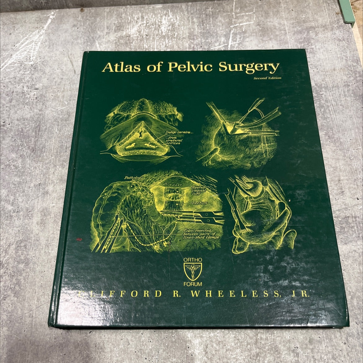 atlas of pelvic surgery book, by Clifford R. Wheeless, Jr., M.D., 1988 Hardcover image 1