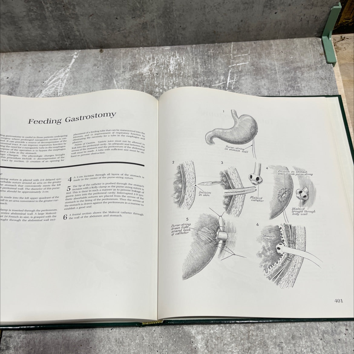 atlas of pelvic surgery book, by Clifford R. Wheeless, Jr., M.D., 1988 Hardcover image 4