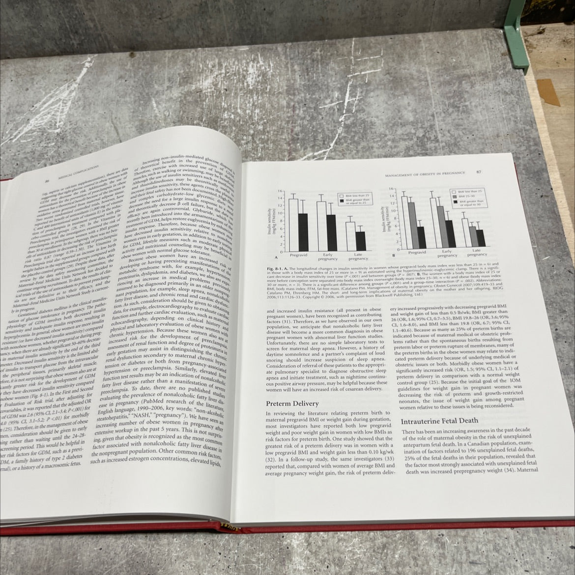 high-risk pregnancy book, by john t. queenan, md, 2007 Hardcover image 4