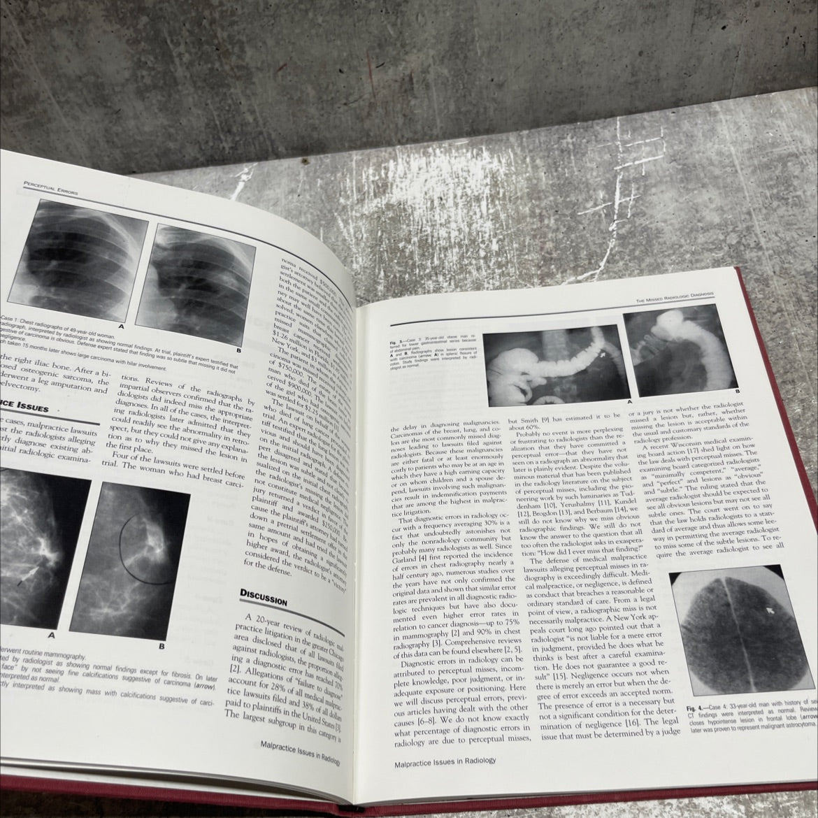 malpractice issues in radiology book, by leonard berlin, 1998 Hardcover image 4