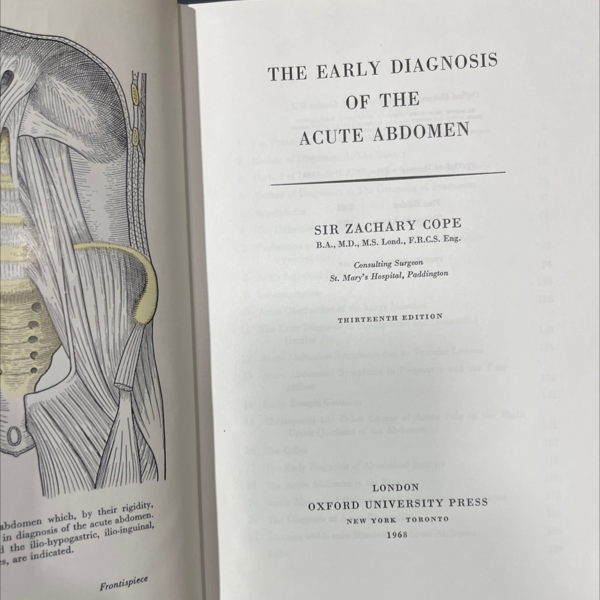 the early diagnosis of the acute abdomen book, by sir zachary cope, 1968 Hardcover image 2